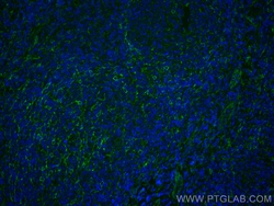 TMEM173/STING Recombinant Rabbit Monoclonal Antibody (7K7), CoraLite488,