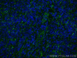 TMEM173/STING Recombinant Rabbit Monoclonal Antibody (7K7), CoraLite488,