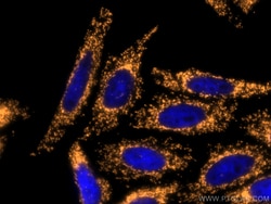 TOM20 Polyclonal Antibody, CoraLite555, Proteintech 100 &mu;L; CoraLite555:Antibodies,