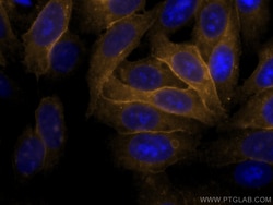 HLA class I ABC Polyclonal Antibody, CoraLite555, Proteintech 100 &mu;L;