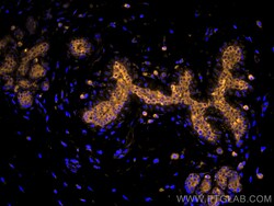 Cytokeratin 19 Monoclonal Antibody (3G1E4), CoraLite555, Proteintech 100