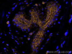 Cytokeratin 19 Monoclonal Antibody (3G1E4), CoraLite555, Proteintech 100