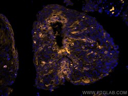 Cytokeratin 19 Monoclonal Antibody (3G1E4), CoraLite555, Proteintech 100