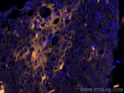 Cytokeratin 19 Monoclonal Antibody (3G1E4), CoraLite555, Proteintech 100