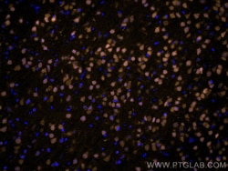 NeuN Monoclonal Antibody (3A4C1), CoraLite555, Proteintech 100 &mu;L; CoraLite555:Antibodies,