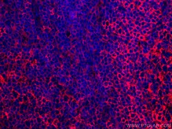 HLA-E Monoclonal Antibody (1A4G3), CoraLite594, Proteintech 100 &mu;L;
