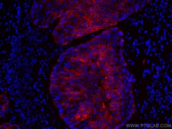 Cytokeratin 5 Monoclonal Antibody (1A1C5), CoraLite594, Proteintech 100