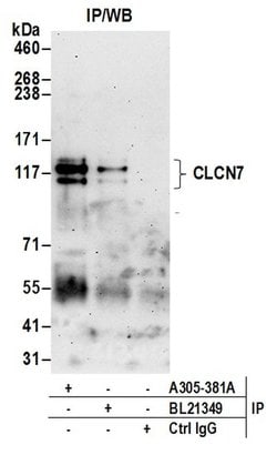 CLCN7 Rabbit anti-Human, Polyclonal, Bethyl Laboratories 10 &mu;l; Unlabeled:Antibodies,