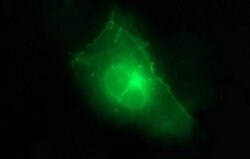CLDN6 Monoclonal Antibody (OTI3G3), TrueMAB , OriGene 100 &mu;L; Unconjugated:Antibodies,