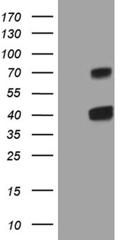 CLEC1A Monoclonal Antibody (OTI1H8), TrueMAB , OriGene 100 &mu;L; Unconjugated:Antibodies,