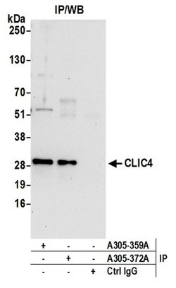 CLIC4 Rabbit anti-Human, Mouse, Polyclonal, Bethyl Laboratories 100 &mu;L;