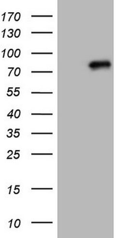 CLINT1 Mouse anti-Human, Clone: OTI6G10, lyophilized, TrueMAB 100 &mu;g;