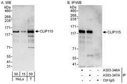 CLIP115 Rabbit anti-Human, Polyclonal, Bethyl Laboratories 100 &mu;L; Unconjugated:Antibodies,