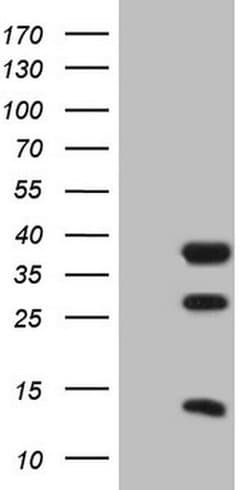 CLOCK Monoclonal Antibody (OTI1G3), TrueMAB , OriGene:Antibodies:Primary