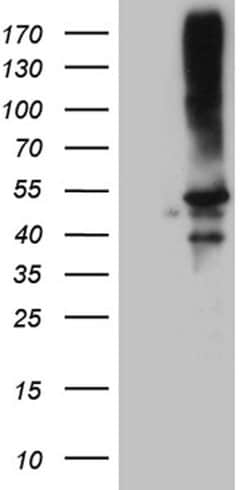 CLP1 Monoclonal Antibody (OTI2D2), TrueMAB , OriGene:Antibodies:Primary