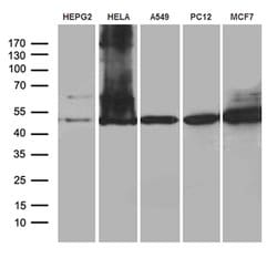 CLP1 Monoclonal Antibody (OTI2D2), TrueMAB , OriGene:Antibodies:Primary