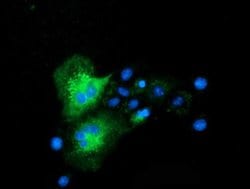 CLPP Monoclonal Antibody (OTI1F6), TrueMAB , OriGene 100 &mu;L; Unconjugated:Antibodies,