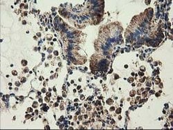 CLPP Mouse anti-Human, Clone: OTI1C7, lyophilized, TrueMAB 100 &mu;g; Unconjugated:Antibodies,