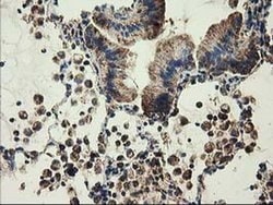 CLPP Monoclonal Antibody (OTI1C7), TrueMAB , OriGene 30 &mu;L; Unconjugated:Antibodies,