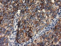 CLPP Monoclonal Antibody (OTI1C7), TrueMAB , OriGene 30 &mu;L; Unconjugated:Antibodies,