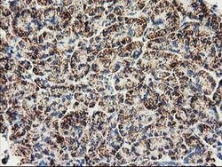 CLPP Mouse anti-Human, Clone: OTI1C7, lyophilized, TrueMAB 100 &mu;g; Unconjugated:Antibodies,