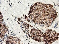CLPP Mouse anti-Human, Clone: OTI1C7, lyophilized, TrueMAB 100 &mu;g; Unconjugated:Antibodies,