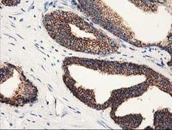 CLPP Monoclonal Antibody (OTI1C7), TrueMAB , OriGene 30 &mu;L; Unconjugated:Antibodies,