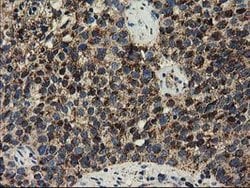 CLPP Mouse anti-Human, Clone: OTI1C7, lyophilized, TrueMAB 100 &mu;g; Unconjugated:Antibodies,