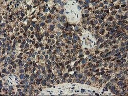 CLPP Monoclonal Antibody (OTI1C7), TrueMAB , OriGene 30 &mu;L; Unconjugated:Antibodies,