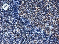 CLPP Mouse anti-Human, Clone: OTI1C7, lyophilized, TrueMAB 100 &mu;g; Unconjugated:Antibodies,