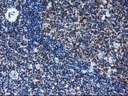 CLPP Monoclonal Antibody (OTI1C7), TrueMAB , OriGene 30 &mu;L; Unconjugated:Antibodies,