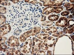 CLPP Mouse anti-Human, Clone: OTI1C7, lyophilized, TrueMAB 100 &mu;g; Unconjugated:Antibodies,