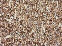 CLPP Mouse anti-Human, Clone: OTI1C7, lyophilized, TrueMAB 100 &mu;g; Unconjugated:Antibodies,
