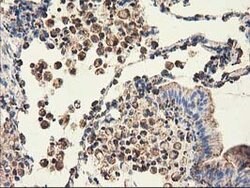 CLPP Mouse anti-Human, Clone: OTI1G9, lyophilized, TrueMAB 100 &mu;g; Unconjugated:Antibodies,