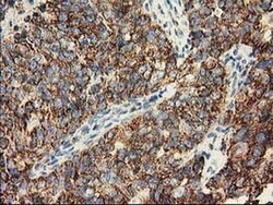 CLPP Monoclonal Antibody (OTI1G9), TrueMAB , OriGene 100 &mu;L; Unconjugated:Antibodies,