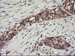 CLPP Mouse anti-Human, Clone: OTI1G9, lyophilized, TrueMAB 100 &mu;g; Unconjugated:Antibodies,
