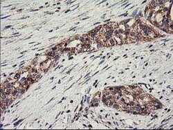 CLPP Monoclonal Antibody (OTI1G9), TrueMAB , OriGene 100 &mu;L; Unconjugated:Antibodies,
