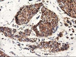 CLPP Mouse anti-Human, Clone: OTI1G9, lyophilized, TrueMAB 100 &mu;g; Unconjugated:Antibodies,