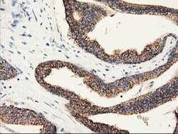 CLPP Mouse anti-Human, Clone: OTI1G9, lyophilized, TrueMAB 100 &mu;g; Unconjugated:Antibodies,