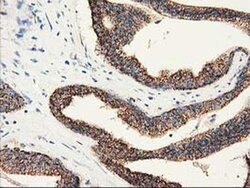 CLPP Monoclonal Antibody (OTI1G9), TrueMAB , OriGene 100 &mu;L; Unconjugated:Antibodies,
