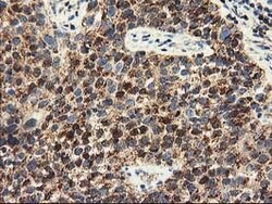 CLPP Mouse anti-Human, Clone: OTI1G9, lyophilized, TrueMAB 100 &mu;g; Unconjugated:Antibodies,