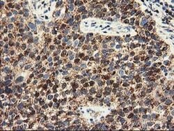 CLPP Monoclonal Antibody (OTI1G9), TrueMAB , OriGene 100 &mu;L; Unconjugated:Antibodies,