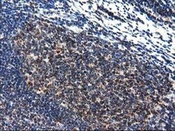 CLPP Monoclonal Antibody (OTI1G9), TrueMAB , OriGene 100 &mu;L; Unconjugated:Antibodies,