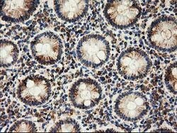 CLPP Mouse anti-Human, Clone: OTI1G9, lyophilized, TrueMAB 100 &mu;g; Unconjugated:Antibodies,