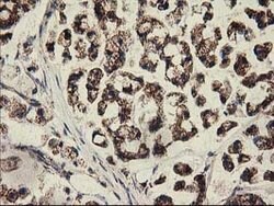 CLPP Mouse anti-Human, Clone: OTI1G9, lyophilized, TrueMAB 100 &mu;g; Unconjugated:Antibodies,