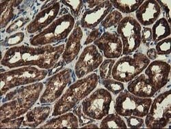 CLPP Mouse anti-Human, Clone: OTI1G9, lyophilized, TrueMAB 100 &mu;g; Unconjugated:Antibodies,