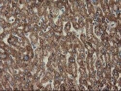 CLPP Mouse anti-Human, Clone: OTI1G9, lyophilized, TrueMAB 100 &mu;g; Unconjugated:Antibodies,
