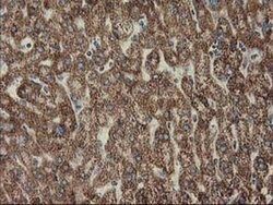 CLPP Monoclonal Antibody (OTI1G9), TrueMAB , OriGene 100 &mu;L; Unconjugated:Antibodies,