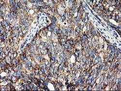 CLPP Monoclonal Antibody (OTI1F6), TrueMAB , OriGene:Antibodies:Primary