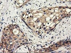 CLPP Monoclonal Antibody (OTI1F6), TrueMAB , OriGene 100 &mu;L; Unconjugated:Antibodies,